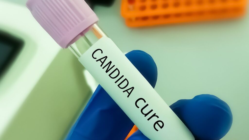 Candida Cure: Natural Ways to Cleanse and Restore Health.