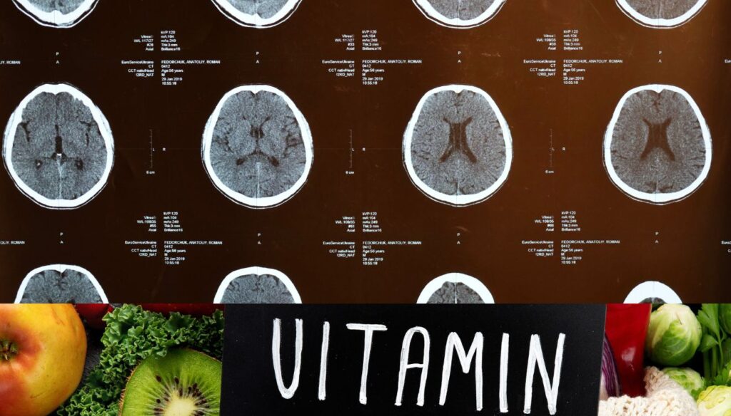 Holistic brain health infographic for cognitive support