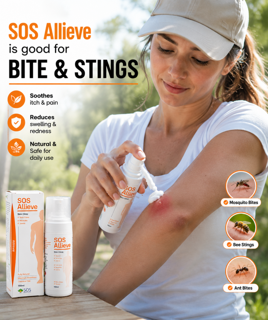 UK Heatwave 2026 Natural Remedy for Bites, Stings & Muscle Pain; SOS Allieve {#bites-relief}