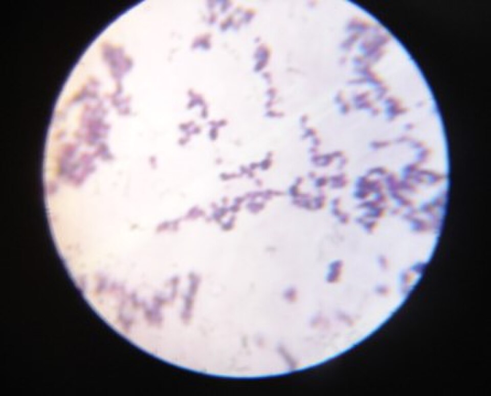candida albicans yeast cells under microscope candida natural cleanse 2026 guide SOS Essentials 