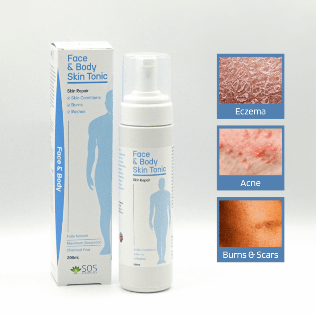 natural immune shield summer 2026 — SOS Face Body Tonic 200ml botanical skin barrier protection by SOS Essentials 