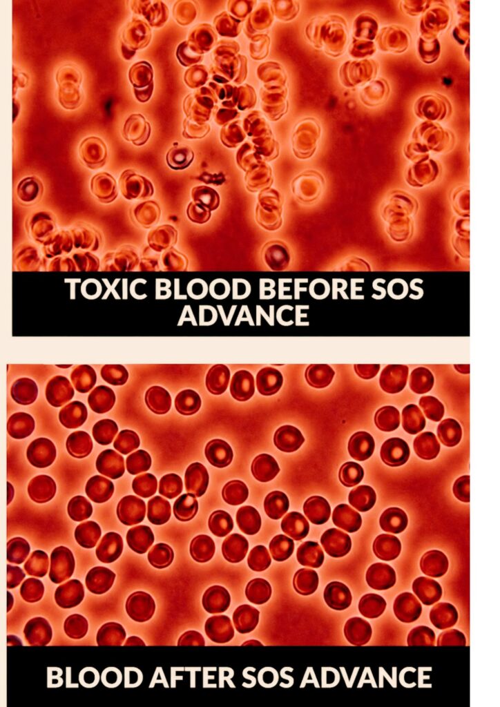 SOS Advance — coconut and 14 essential oils at pH 10.5. The alkaline, anti-viral, antifungal, antiparasitic botanical formula at the core of a natural immune shield summer 2026.