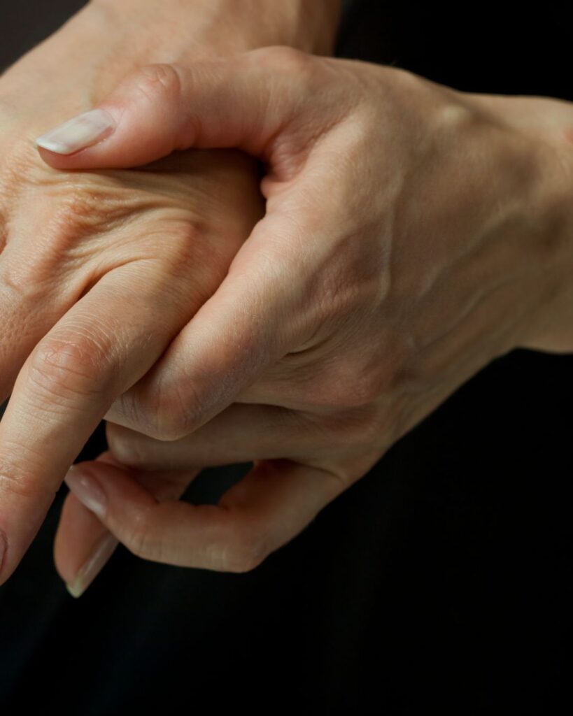 arthritis joint inflammation hands
